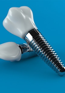 Patient in Parker getting a dental cleaning