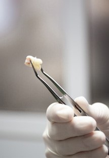 Patient in Parker smiling after cosmetic dentistry