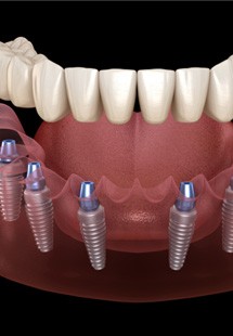 Patient in Parker showing red gums