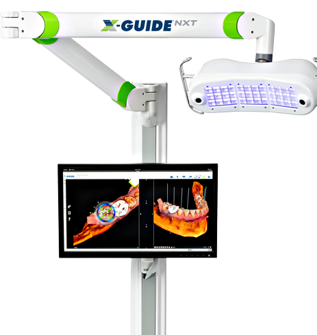 Screen attached to an X Guide machine